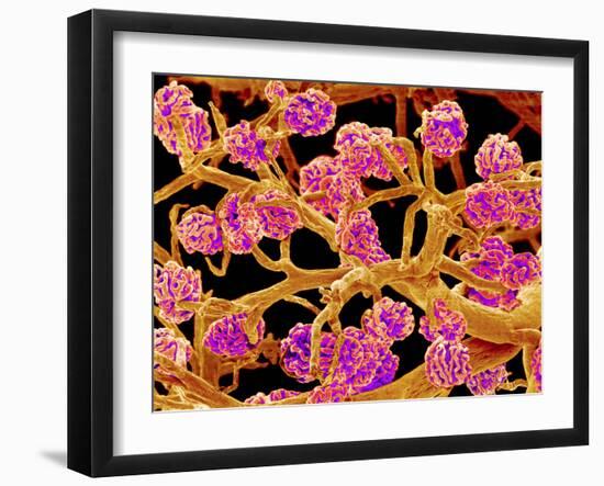 Kidney Glomeruli, SEM-Susumu Nishinaga-Framed Photographic Print