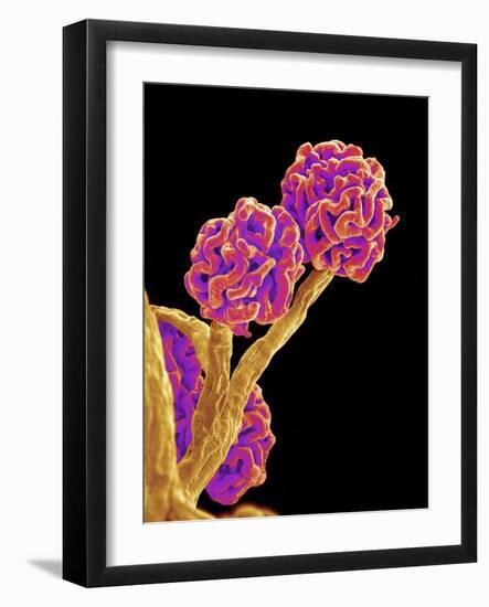 Kidney Glomeruli, SEM-Susumu Nishinaga-Framed Photographic Print