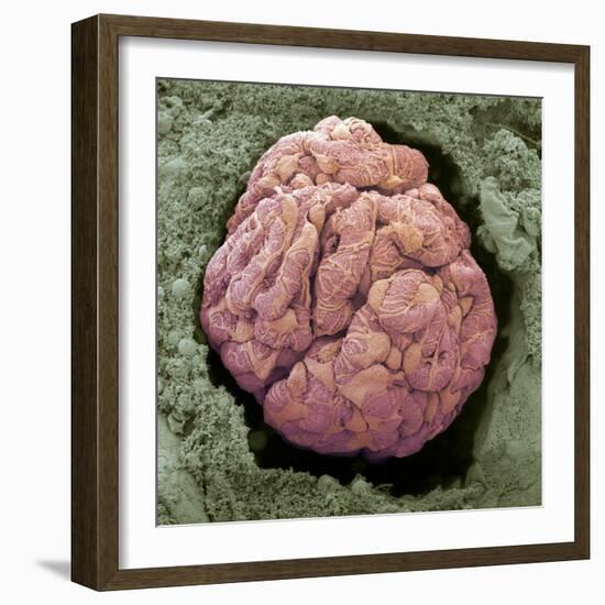 Kidney Glomerulus, SEM-Steve Gschmeissner-Framed Premium Photographic Print