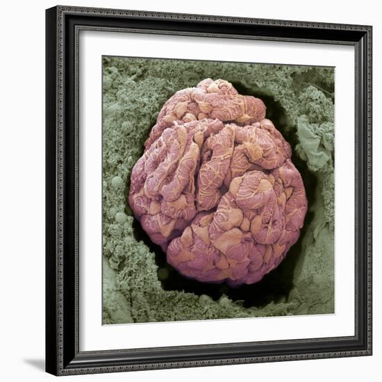 Kidney Glomerulus, SEM-Steve Gschmeissner-Framed Premium Photographic Print