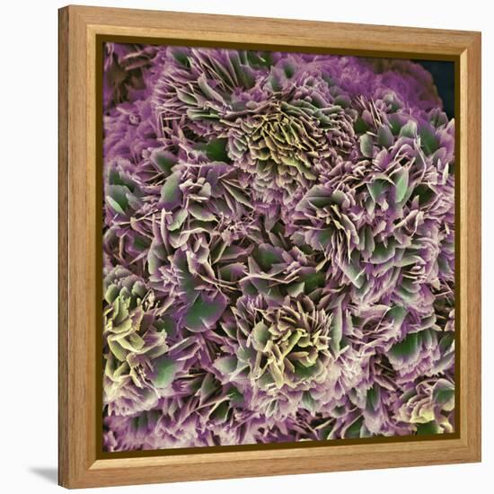 Kidney Stone Crystals, SEM-Steve Gschmeissner-Framed Premier Image Canvas