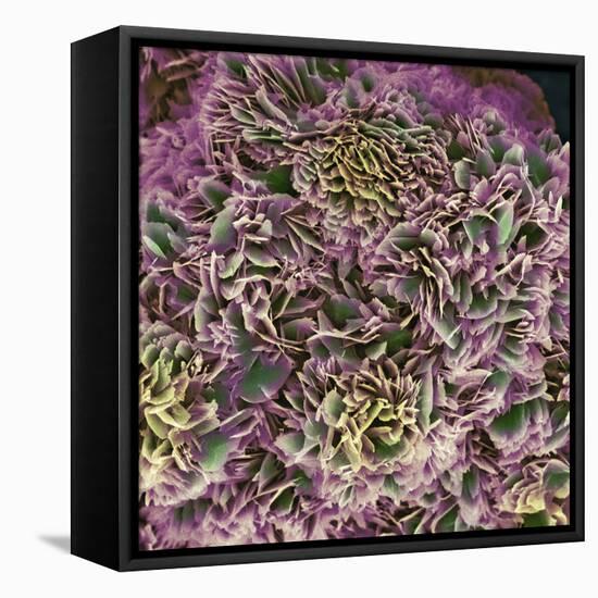 Kidney Stone Crystals, SEM-Steve Gschmeissner-Framed Premier Image Canvas