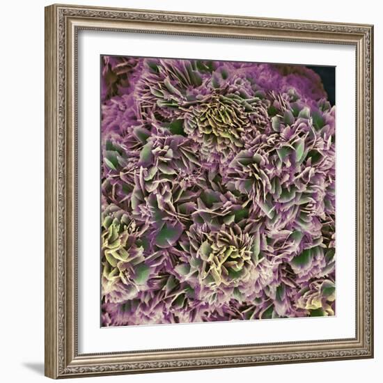 Kidney Stone Crystals, SEM-Steve Gschmeissner-Framed Premium Photographic Print