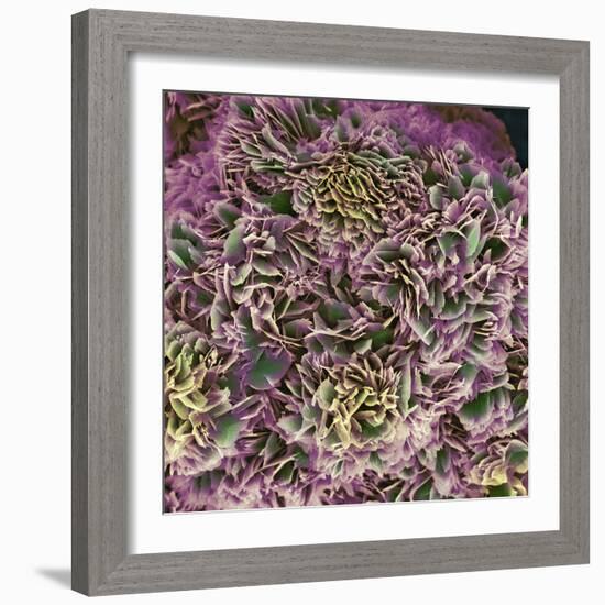 Kidney Stone Crystals, SEM-Steve Gschmeissner-Framed Premium Photographic Print