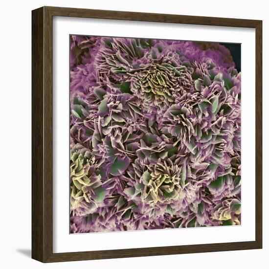 Kidney Stone Crystals, SEM-Steve Gschmeissner-Framed Premium Photographic Print