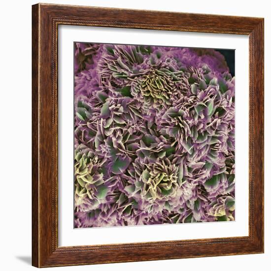 Kidney Stone Crystals, SEM-Steve Gschmeissner-Framed Premium Photographic Print