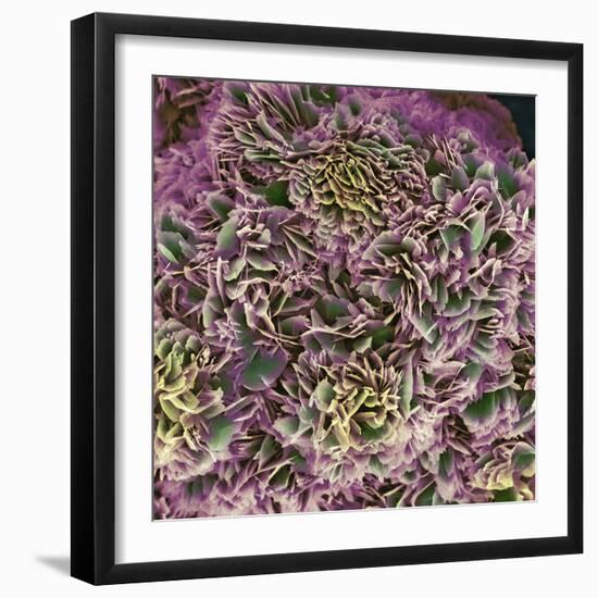 Kidney Stone Crystals, SEM-Steve Gschmeissner-Framed Premium Photographic Print