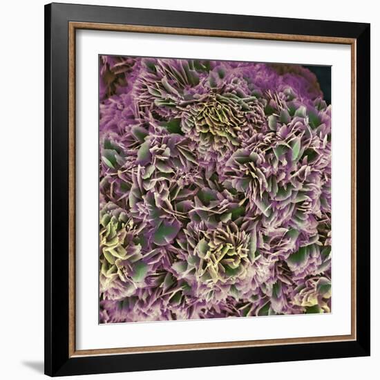 Kidney Stone Crystals, SEM-Steve Gschmeissner-Framed Premium Photographic Print