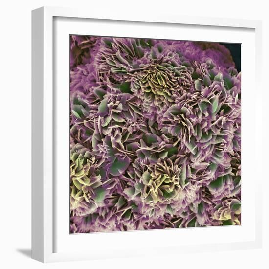 Kidney Stone Crystals, SEM-Steve Gschmeissner-Framed Premium Photographic Print