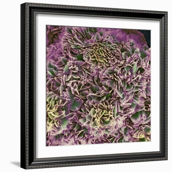 Kidney Stone Crystals, SEM-Steve Gschmeissner-Framed Premium Photographic Print