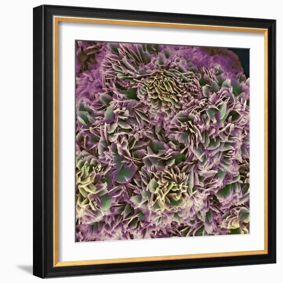 Kidney Stone Crystals, SEM-Steve Gschmeissner-Framed Premium Photographic Print