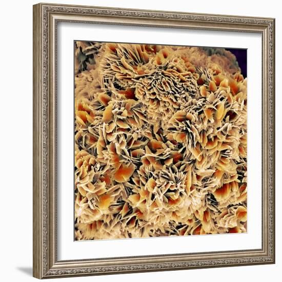 Kidney Stone Crystals, SEM-Steve Gschmeissner-Framed Premium Photographic Print