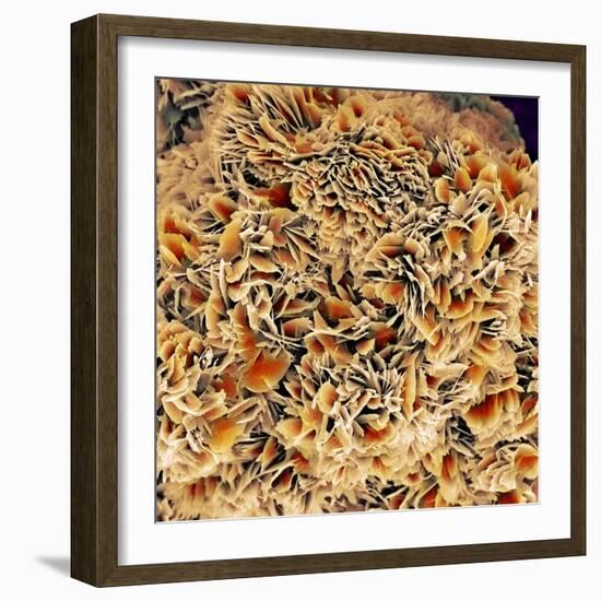 Kidney Stone Crystals, SEM-Steve Gschmeissner-Framed Premium Photographic Print