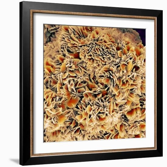 Kidney Stone Crystals, SEM-Steve Gschmeissner-Framed Premium Photographic Print