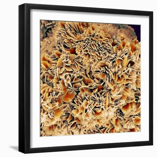 Kidney Stone Crystals, SEM-Steve Gschmeissner-Framed Premium Photographic Print
