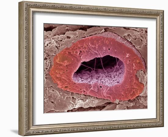 Kidney Tubule, SEM-Steve Gschmeissner-Framed Photographic Print