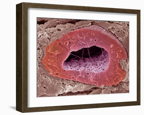 Kidney Tubule, SEM-Steve Gschmeissner-Framed Photographic Print