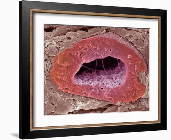 Kidney Tubule, SEM-Steve Gschmeissner-Framed Photographic Print