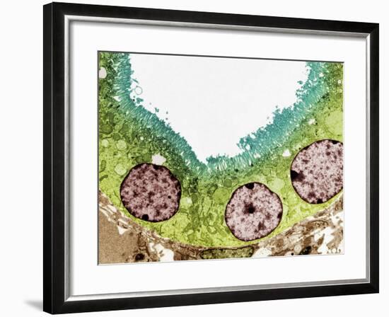 Kidney Tubule, TEM-Steve Gschmeissner-Framed Photographic Print