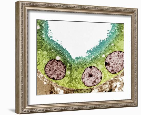 Kidney Tubule, TEM-Steve Gschmeissner-Framed Photographic Print