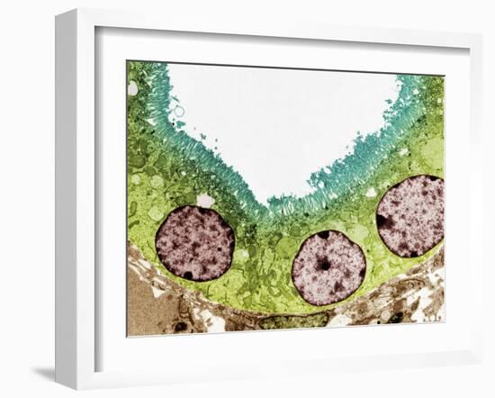 Kidney Tubule, TEM-Steve Gschmeissner-Framed Photographic Print