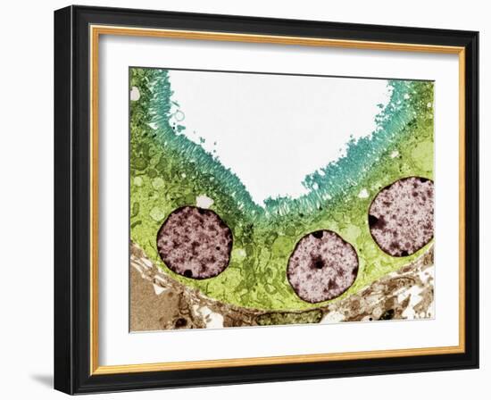 Kidney Tubule, TEM-Steve Gschmeissner-Framed Photographic Print