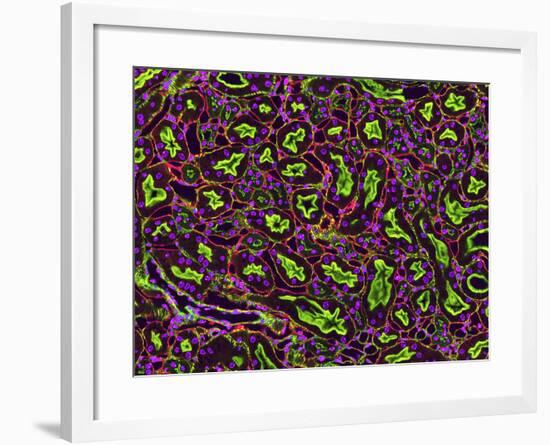 Kidney Tubules In Section-Thomas Deerinck-Framed Photographic Print