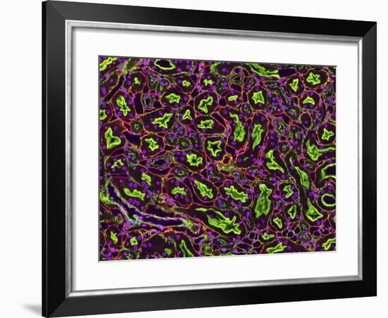 Kidney Tubules In Section-Thomas Deerinck-Framed Photographic Print