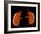 Kidneys, Artwork-Laguna Design-Framed Photographic Print