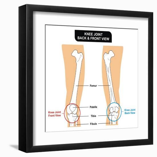 Knee Joint - Bones (Femur, Tibia, Fibula, Patella)-udaix-Framed Art Print