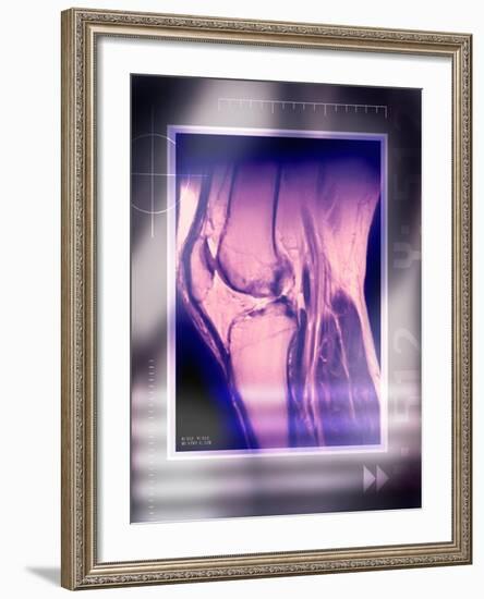 Knee Joint, Side View, MRI Scan-Miriam Maslo-Framed Photographic Print