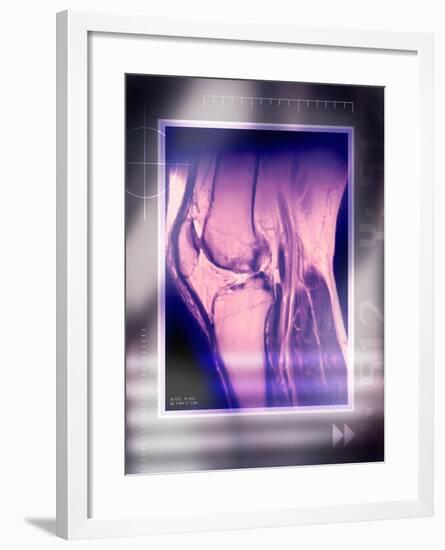 Knee Joint, Side View, MRI Scan-Miriam Maslo-Framed Photographic Print