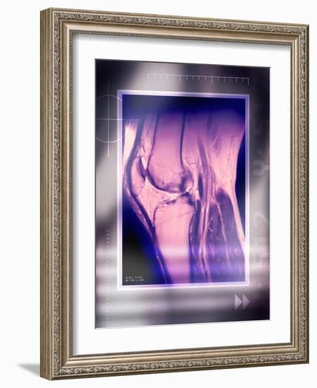 Knee Joint, Side View, MRI Scan-Miriam Maslo-Framed Photographic Print