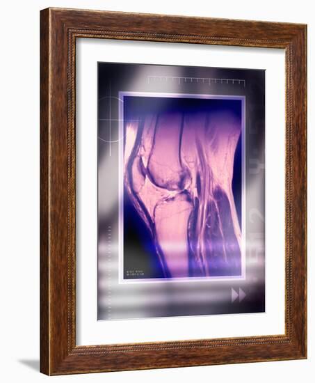 Knee Joint, Side View, MRI Scan-Miriam Maslo-Framed Photographic Print