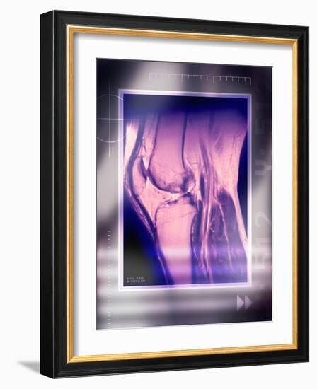 Knee Joint, Side View, MRI Scan-Miriam Maslo-Framed Photographic Print