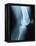 Knee Joint X-Ray-Robert Llewellyn-Framed Premier Image Canvas