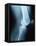 Knee Joint X-Ray-Robert Llewellyn-Framed Premier Image Canvas