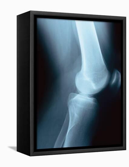 Knee Joint X-Ray-Robert Llewellyn-Framed Premier Image Canvas