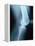 Knee Joint X-Ray-Robert Llewellyn-Framed Premier Image Canvas