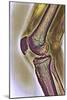 Knee Joint, X-ray-null-Mounted Photographic Print