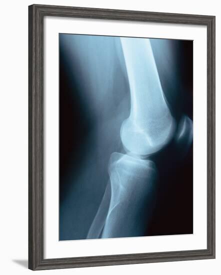 Knee Joint X-Ray-Robert Llewellyn-Framed Photographic Print