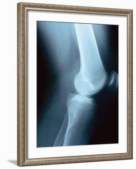 Knee Joint X-Ray-Robert Llewellyn-Framed Photographic Print