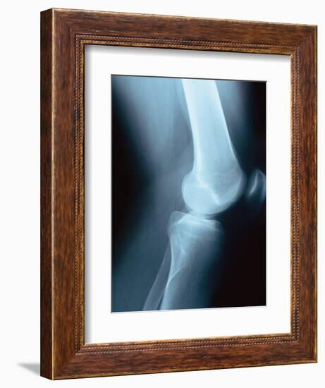 Knee Joint X-Ray-Robert Llewellyn-Framed Photographic Print