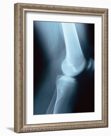 Knee Joint X-Ray-Robert Llewellyn-Framed Photographic Print