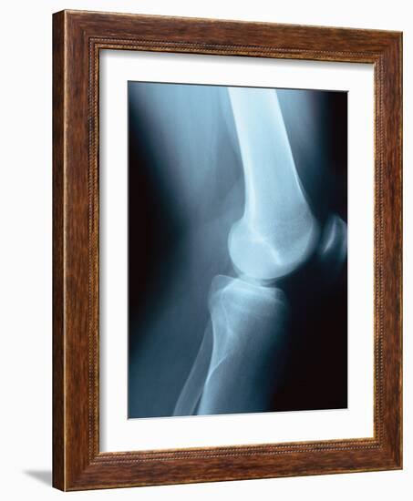 Knee Joint X-Ray-Robert Llewellyn-Framed Photographic Print