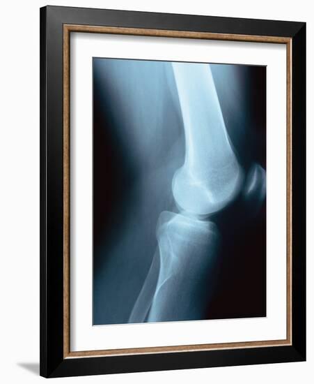 Knee Joint X-Ray-Robert Llewellyn-Framed Photographic Print