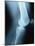 Knee Joint X-Ray-Robert Llewellyn-Mounted Photographic Print