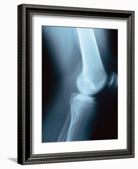 Knee Joint X-Ray-Robert Llewellyn-Framed Photographic Print