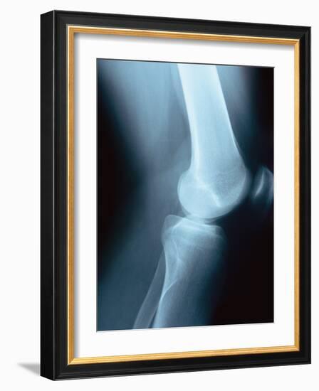 Knee Joint X-Ray-Robert Llewellyn-Framed Photographic Print