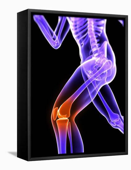 Knee Pain, Conceptual Artwork-SCIEPRO-Framed Premier Image Canvas